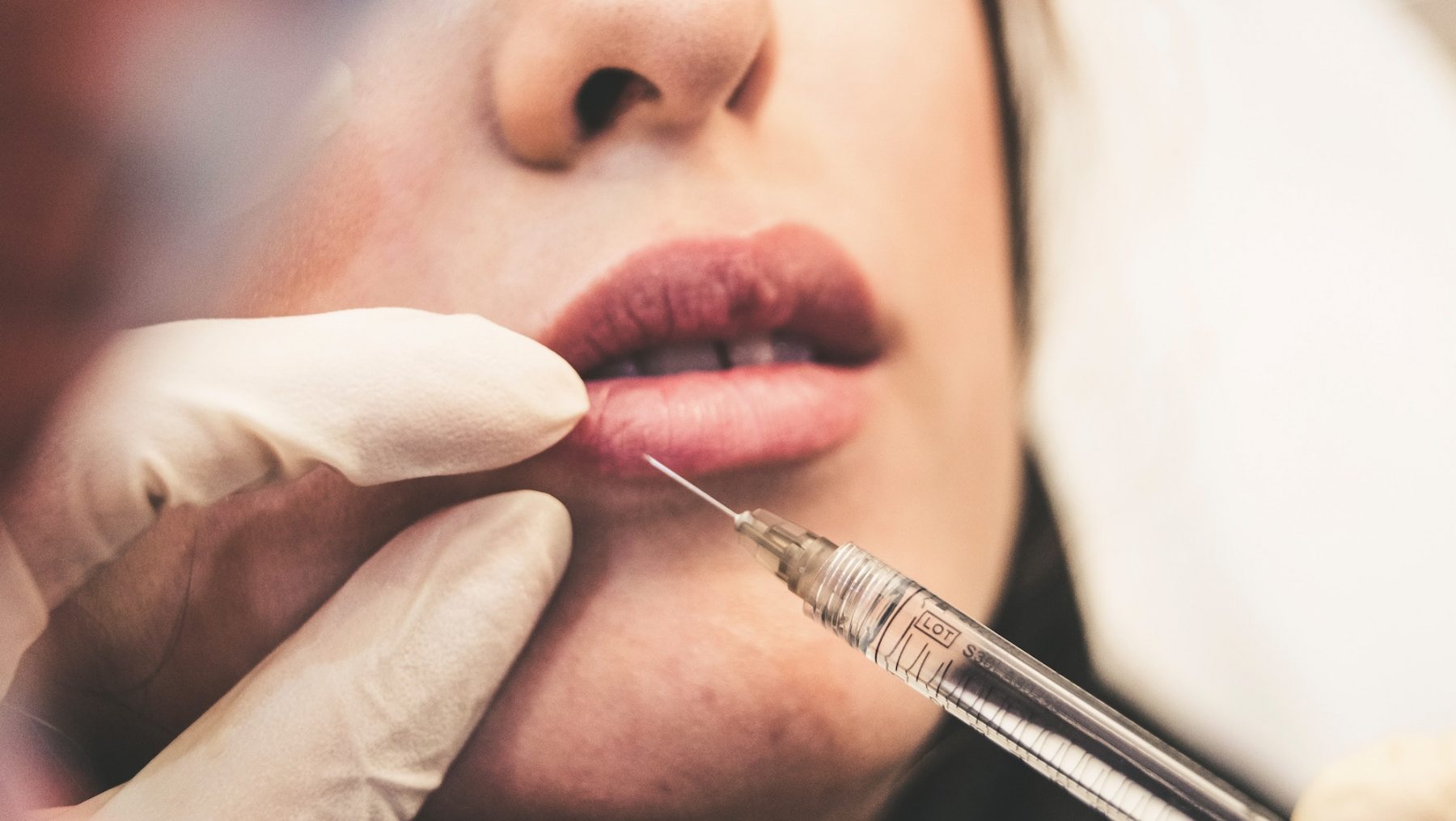 botox filllers cosmetische ingrepen jongeren minimumleeftijd cda