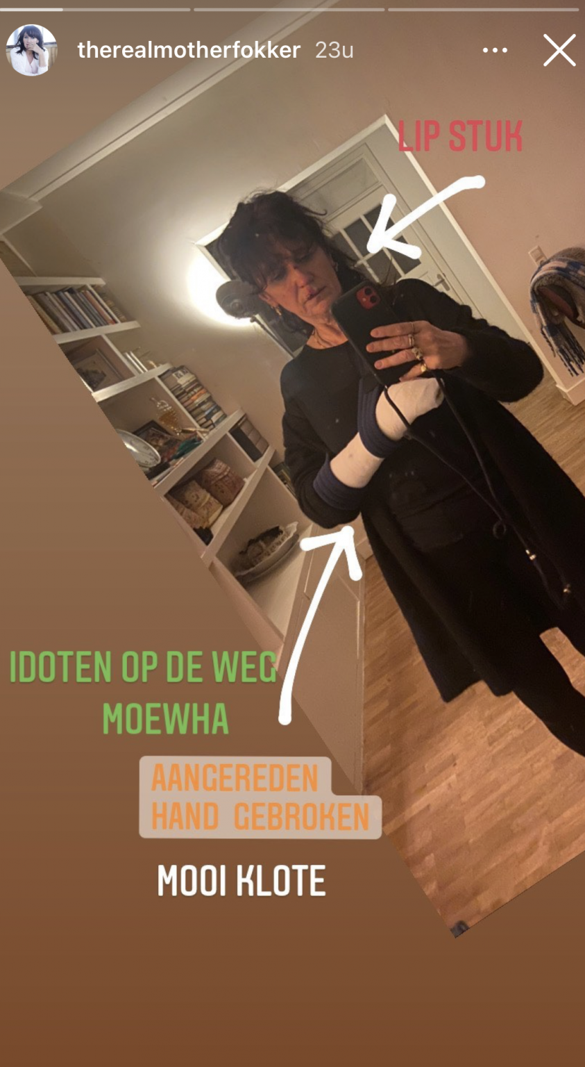 Actrice en 'WIDM'-kandidaat Renée Fokker gewond door ...