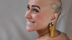 Thumbnail voor Veronique (31) organiseert Alopecia Dag na verliezen haar: 'Ik kan nu zeggen: wat ben ik een lekker wijf'