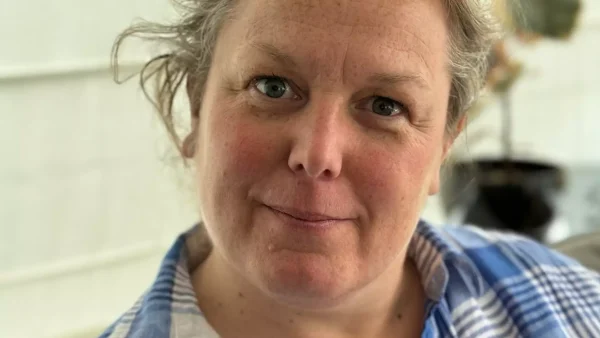 Renée heeft een blue nevus melanoom: '20 jaar lang geen idee'