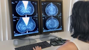 Thumbnail voor Borstkankervereniging wil MRI-scan voor vrouwen met zeer dicht borstklierweefsel: 'Kunnen niet langer wachten'